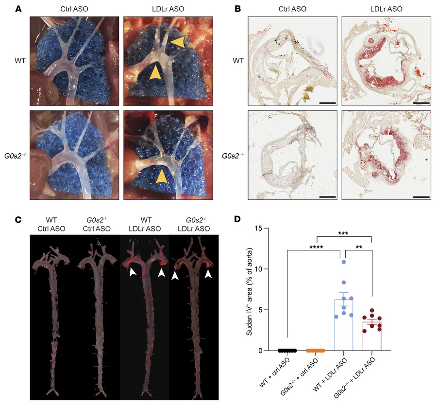
G0s2 deficiency attenuates atherosclerosis.
(A) Representative images s...