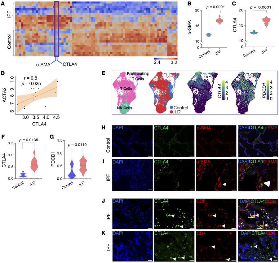 The immune checkpoint inhibitor CTLA4 is upregulated within fibrotic nic...