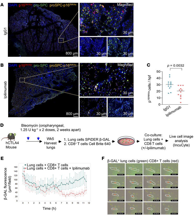 CTLA4 blockade decreases the accumulation of p16INK4a-expressing cells i...
