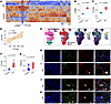 The immune checkpoint inhibitor CTLA4 is upregulated within fibrotic niches