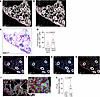CTLA4 is upregulated on CD8+ T cells adjacent to COL5A2-expressing cells in