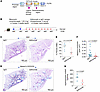 CTLA4 blockade in a mouse model of persistent lung fibrosis ameliorates fib
