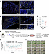 CTLA4 blockade decreases the accumulation of p16INK4a-expressing cells in v