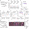 Improvement of pathologies by ferrostatin-1 in DUX4-Tg mice.