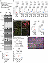 Iron supplementation suppresses DUX4-activated ferroptosis-related pathway.