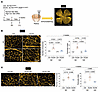 Iron supplementation improves retinal capillary abnormalities.