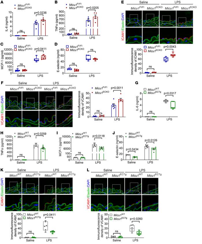MICU1 attenuates EC inflammation in vivo.
(A–D) ELISA of IL-6 (A, n = 6)...