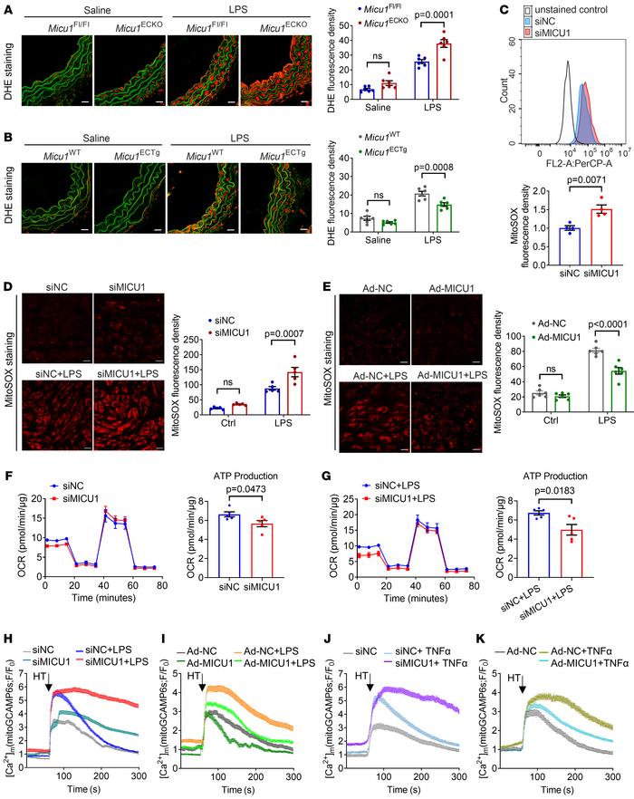 MICU1 regulates mitochondrial Ca2+ uptake and ROS production in ECs.
(A ...