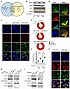 FBXO11 promotes mitochondrial trafficking of LONP1.