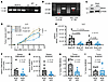 Loss of BRD4 in the myeloid compartment results in decreased MDSC frequency