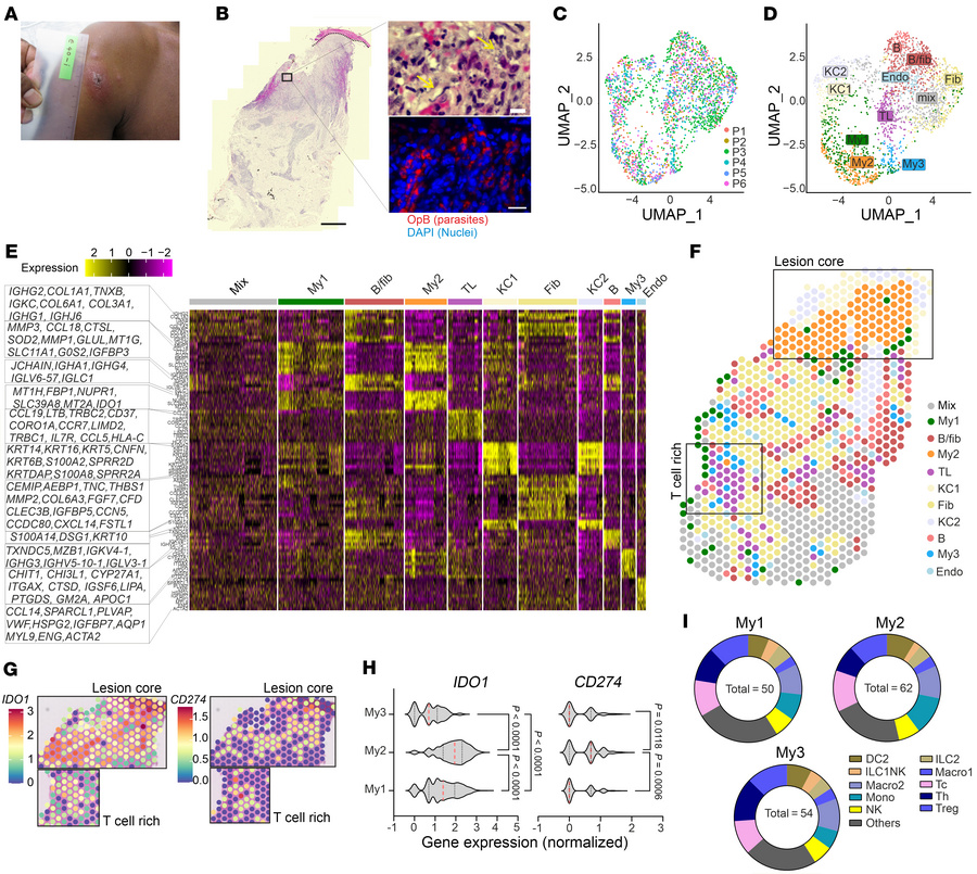 Visium analysis of spatial niches in L. donovani CL lesions.
(A and B) P...