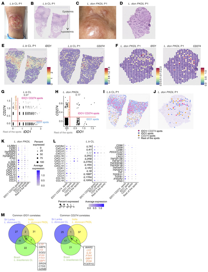 Visium spatial transcriptomics of IDO1 and CD274 niches in different der...