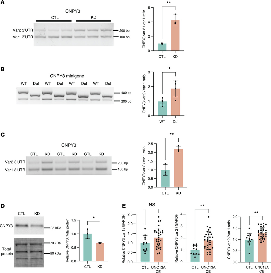
CNPY3 APA increases the expression of an isoform variant with an altern...