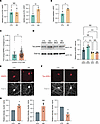 MARK3 APA corresponds with increased MARK3 transcript levels, increased tau