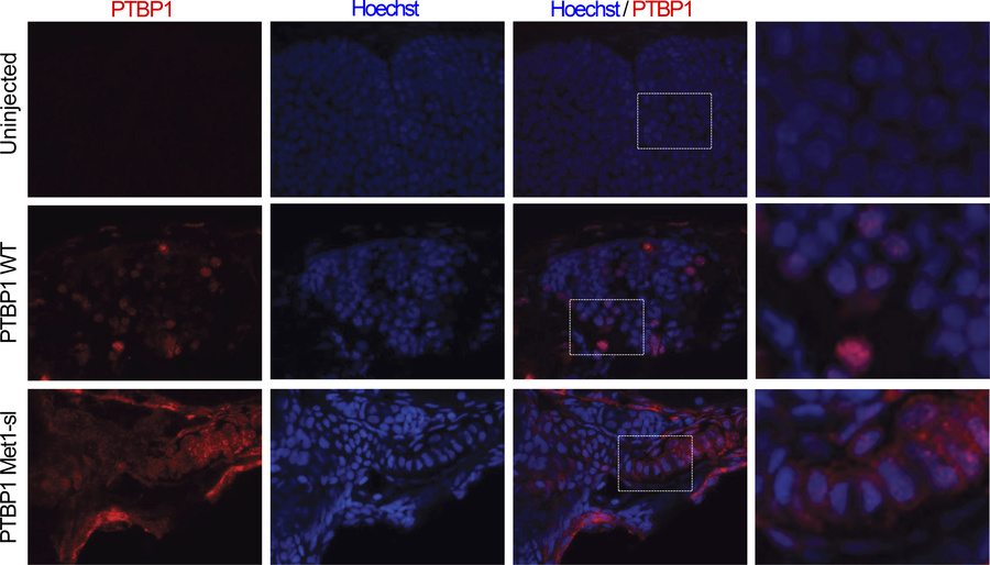 Expression of human PTBP1 variants in zebrafish.
PTBP1 (red) immunofluor...