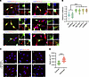 Cytoplasmic colocalization of start-loss PTBP1 variants with P-bodies.