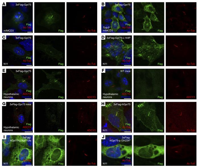 GPR75 is located in the primary cilia.
(A) mIMCD3 cells expressing 3xFla...
