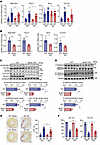 Bcat1 deficiency attenuates mouse cardiac fibrosis and improves cardiac fun
