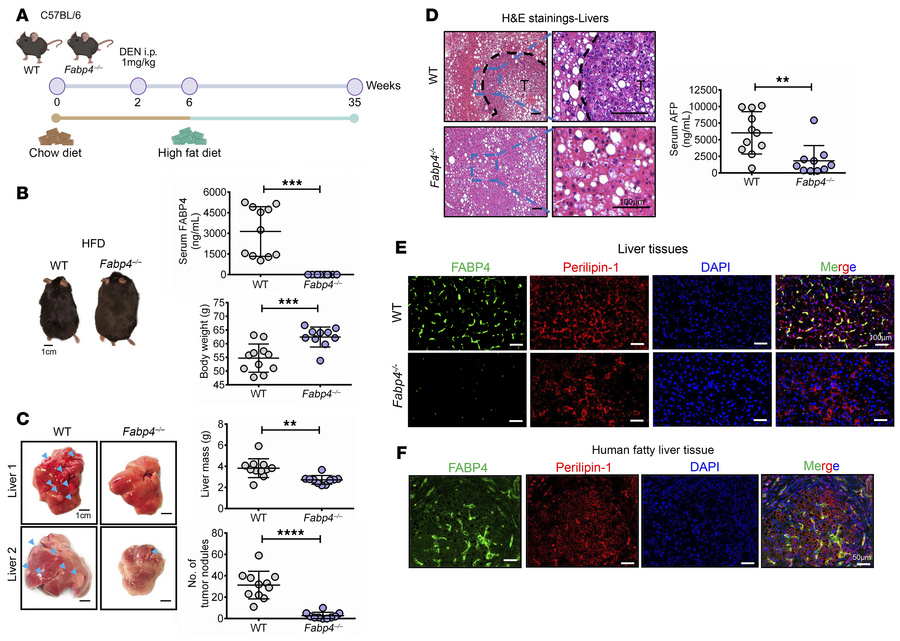FABP4 deficiency delayed the onset of tumor development in DEN-injected ...