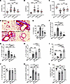 Direct induction of mitochondrial fusion enhances Treg-mediated treatment o