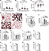 ACC1 inhibition enhances Treg-mediated treatment of chronic GVHD.