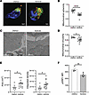 ACC1 inhibition enhances mitochondrial fusion and elongation.