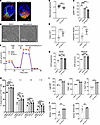 Direct induction of mitochondrial fusion enhances Treg metabolic and suppre