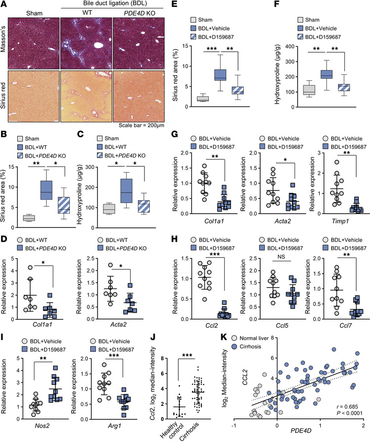 The PDE4D promotes the progression of liver fibrosis.
(A) Representative...