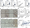 Expression levels of PDE4D in the liver disease.
