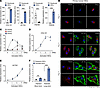 PDE4D is upregulated in culture-activated HSCs.