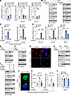 PDE4D upregulates profibrogenic genes in HSCs via regulating the SMAD signa