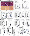 The PDE4D promotes the progression of liver fibrosis.