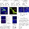 Adoptive transfer of FRCs promotes immune regulatory environment in DLNs.