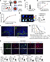 Nano delivery of CXCL12 to LNs prolongs heart allograft survival.