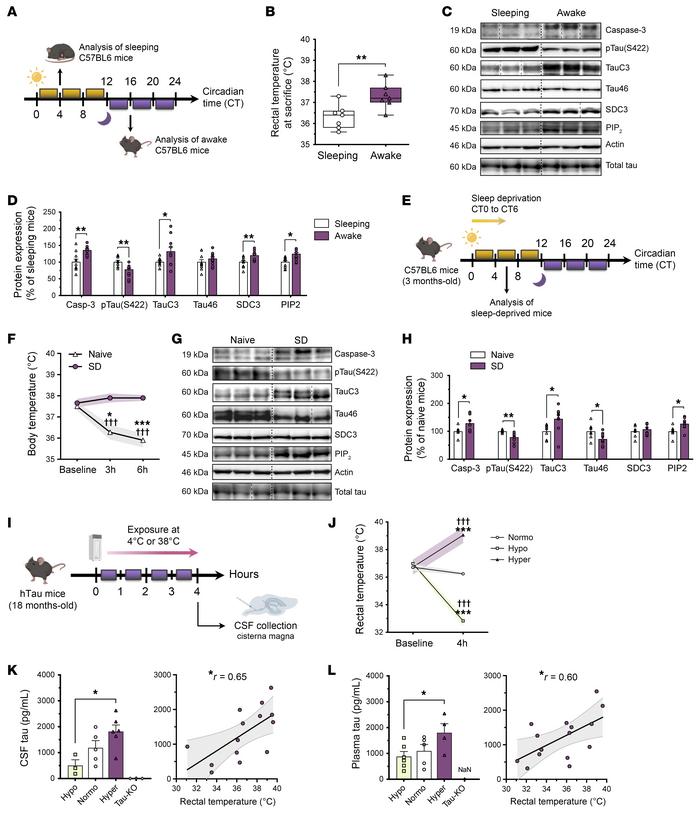 Wakefulness, SD, and mild hyperthermia promote UPS-I–dependent tau relea...