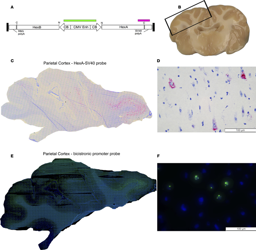 Vector biodistribution assessment by RNAscope and BaseScope.
(A) HexA-SV...