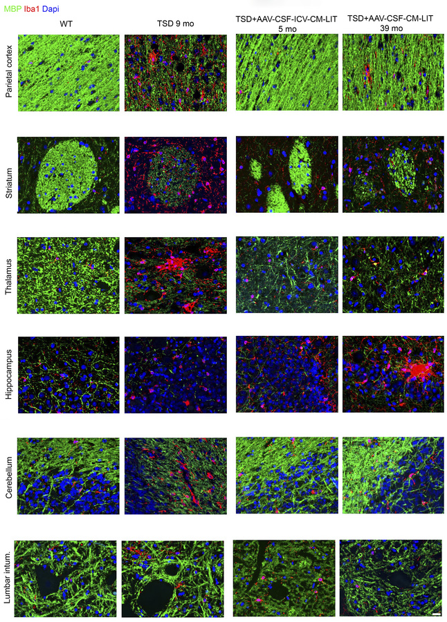 Immunofluorescence evaluation of white matter and glia in sheep CNS up t...