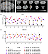 HexA activity and GM2 ganglioside levels in CNS after bicistronic AAV admin