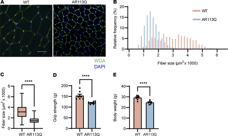 AR113Q males exhibit skeletal muscle atrophy and weakness at 26 weeks.
(...