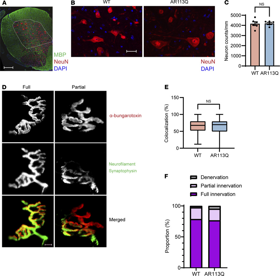 AR113Q males exhibit no significant spinal cord or NMJ pathology at 26 w...