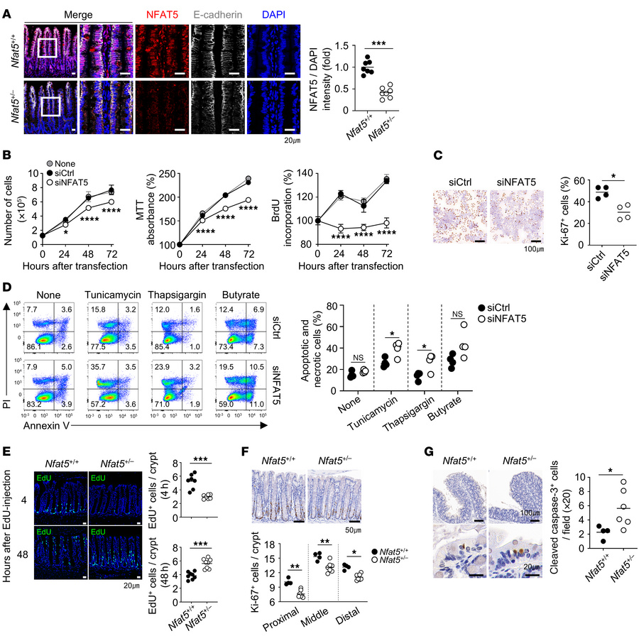 NFAT5 promotes the proliferation and survival of IECs.
(A) Representativ...