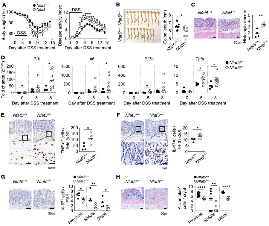 NFAT5 protects mice against DSS-induced colitis.
Nfat5+/+ and Nfat5+/– m...