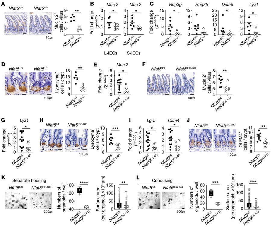 NFAT5 facilitates mucin and antimicrobial compound production in goblet ...