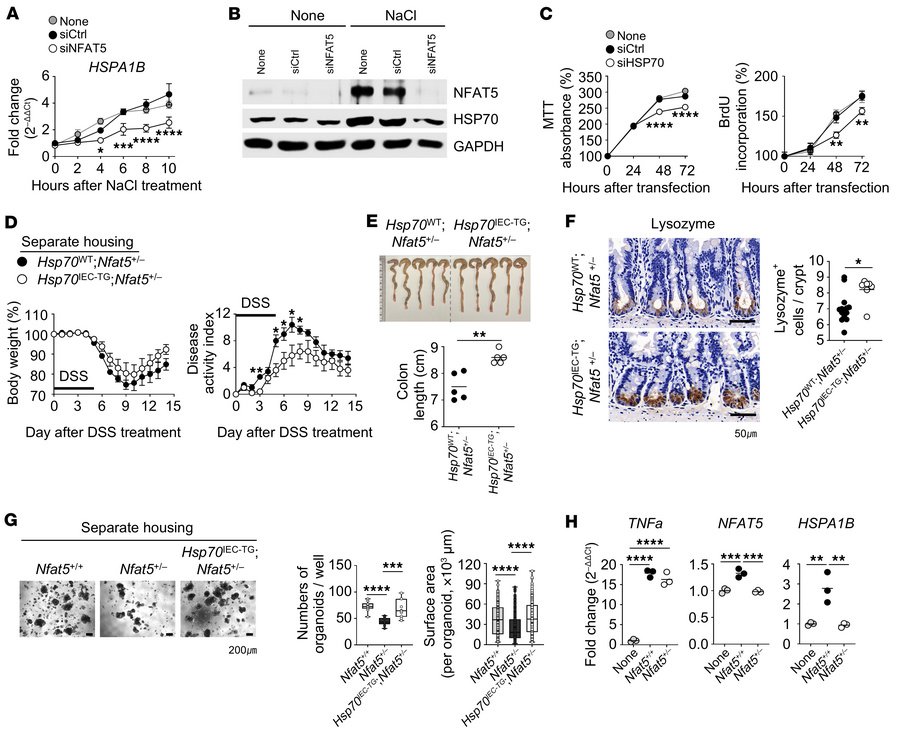 The NFAT5/HSP70 axis prevents DSS-induced colitis in mice.
(A and B) Rel...