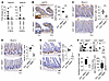 NFAT5 deficiency exacerbates spontaneous colitis in Il10-deficient mice by