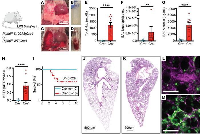 Shp1 deletion in neutrophils leads to severe pulmonary hemorrhage and in...