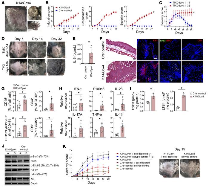Gpx4 depletion in select K14+ KCs produces T cell–dependent psoriasiform...