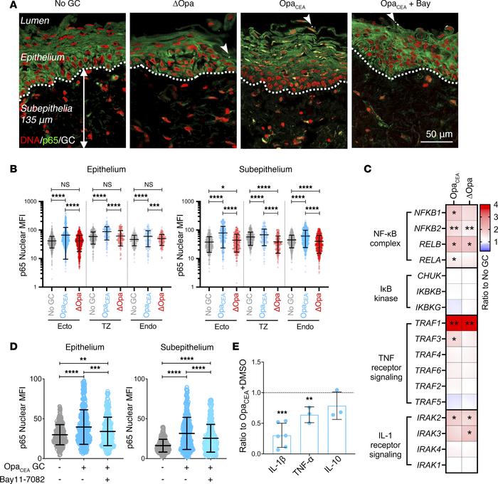 NF-κB is involved in GC-induced proinflammatory cytokine production by t...
