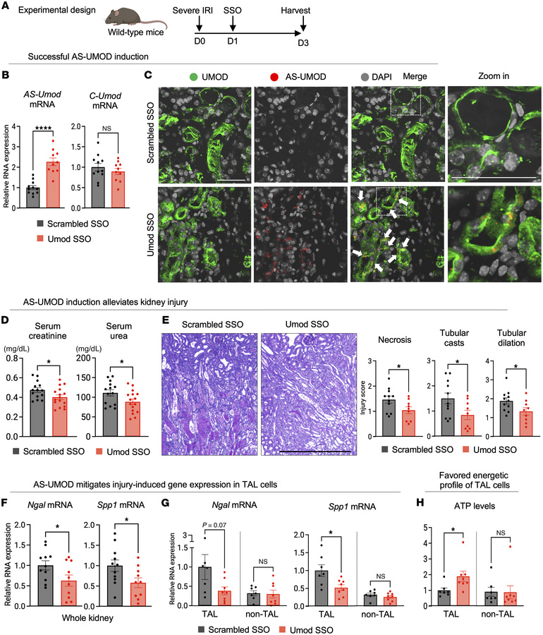 AS-UMOD induction protects TAL cells and ameliorates severe IRI.
WT mice...
