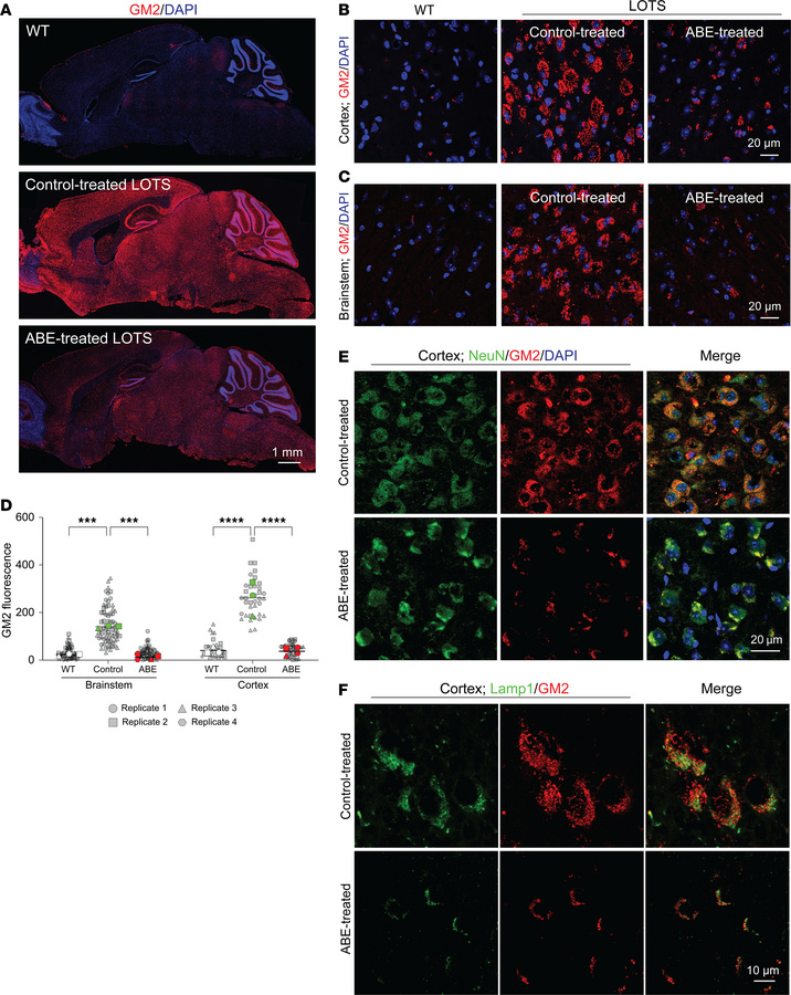 Base-editor treatment reduces brain GM2 ganglioside accumulation in LOTS...
